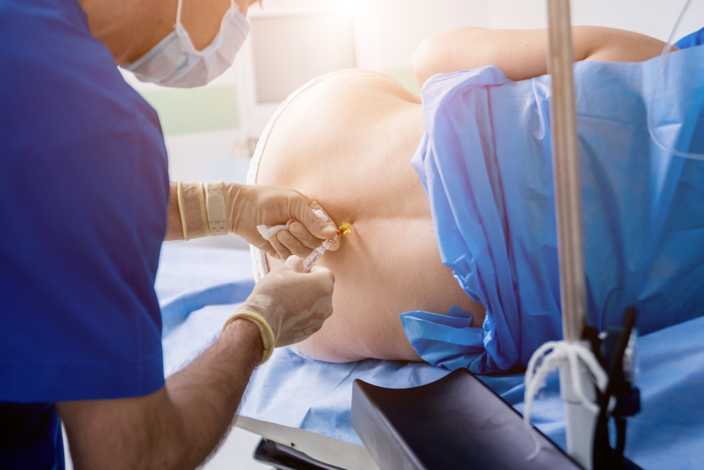 Las epidurales se usan ampliamente fuera de la sala de partos, entonces, ¿cómo funcionan?