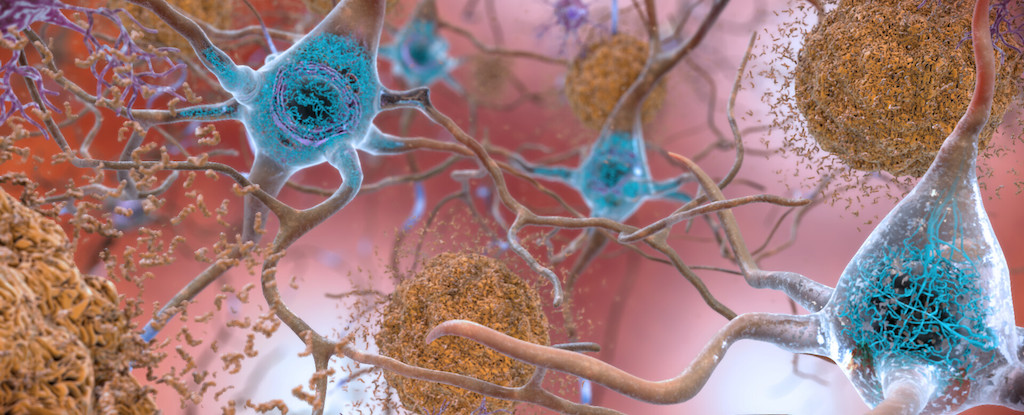 Reducir su ‘edad bioenergética’ puede evitar el Alzheimer, el estudio encuentra: Sciencealert