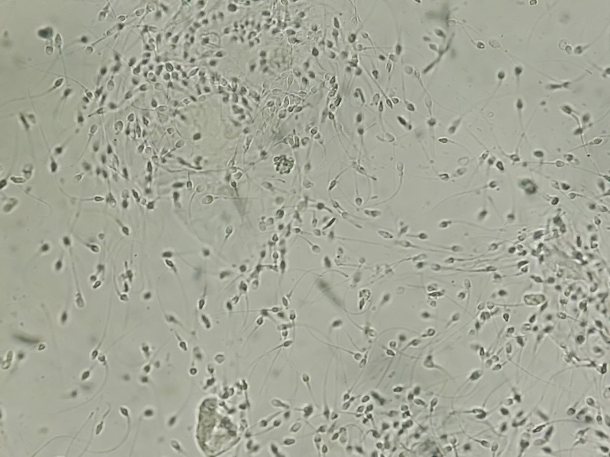 Estudio vincula la calidad de los espermatozoides a la vida útil «Euro Weekly News