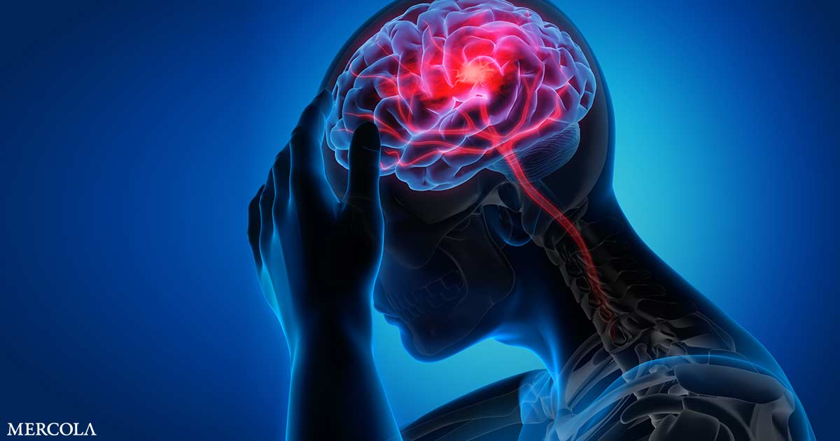 Sobrecarga de hierro identificado como un impulsor clave de la lesión relacionada con el accidente cerebrovascular
