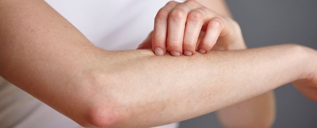Los hongos en tu piel podrían producir un antibiótico potente para combatir las infecciones: Sciencealert
