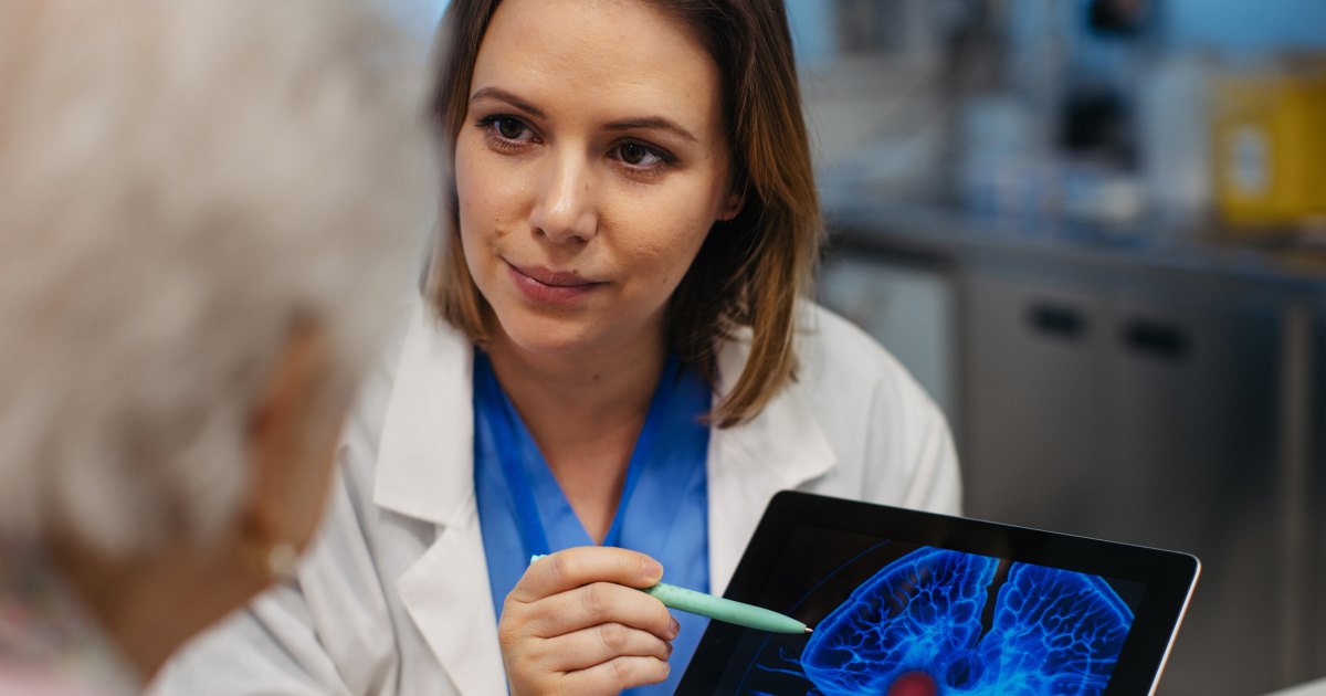 5 Señales de advertencia de un accidente cerebrovascular: consejos de médicos y expertos