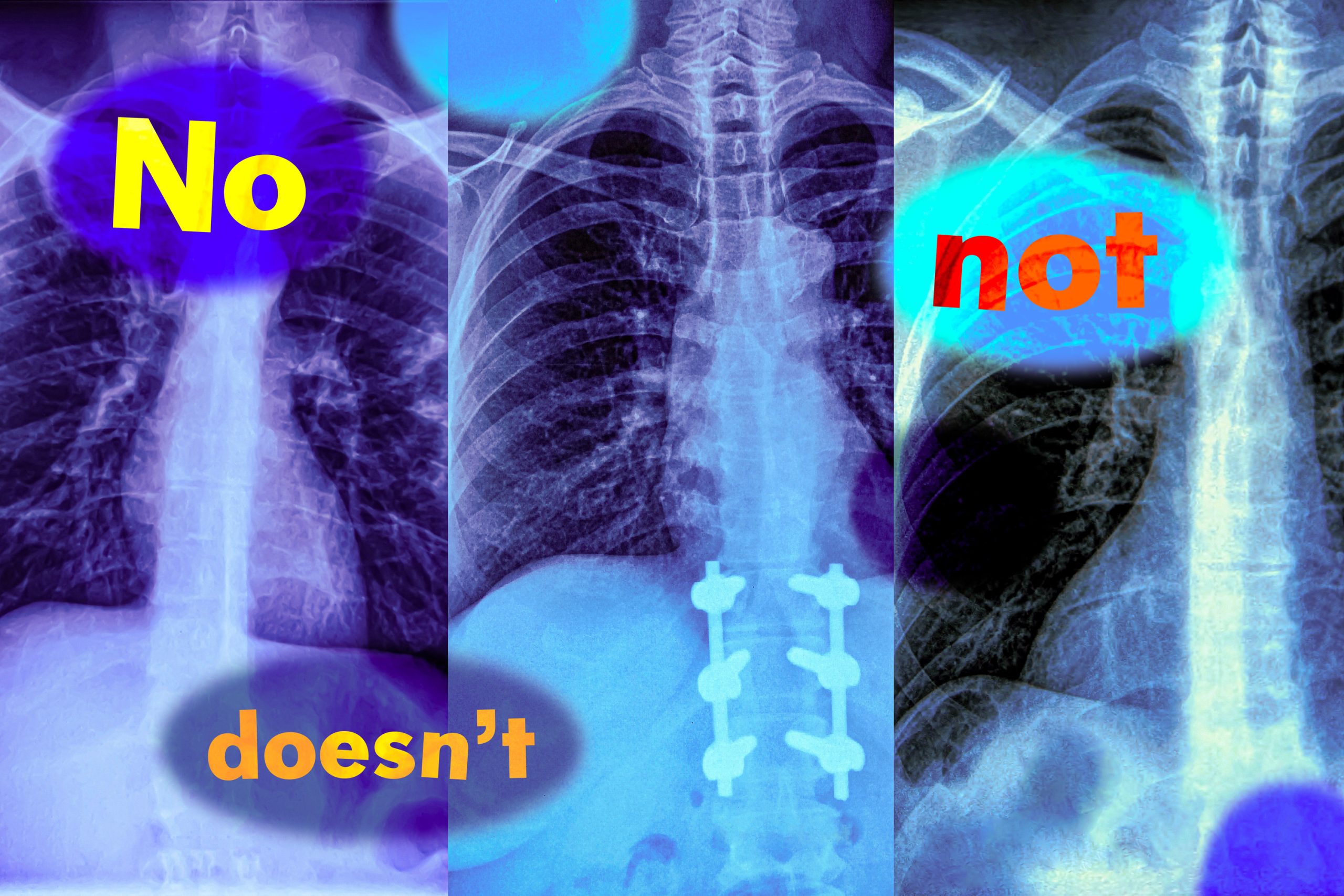 El estudio muestra que los modelos en idioma de visión no pueden manejar consultas con palabras de negación | MIT News