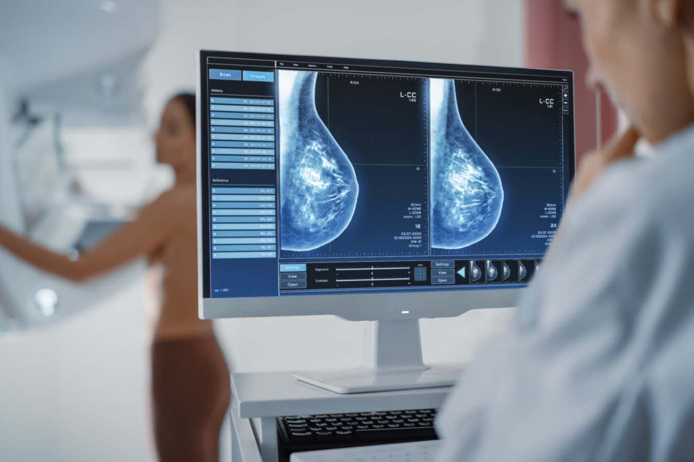 La detección adicional del cáncer podría ayudar a recoger casos tempranos en senos densos