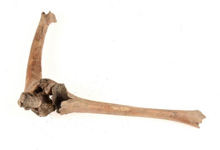 El esqueleto medieval revela cómo era la vida con una discapacidad en la edad media