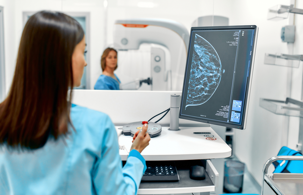 Los patrones en el tejido mamario podrían revelar el riesgo de cáncer de mama invasivo