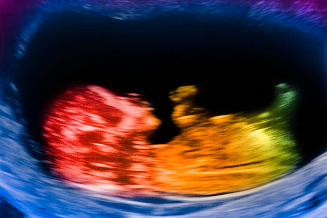 Nuestros grandes cerebros pueden haber evolucionado debido a las hormonas sexuales placentarias