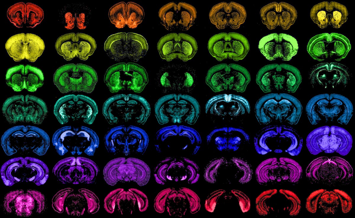 Los virus de ingeniería están transformando la neurociencia y el tratamiento de la enfermedad cerebral