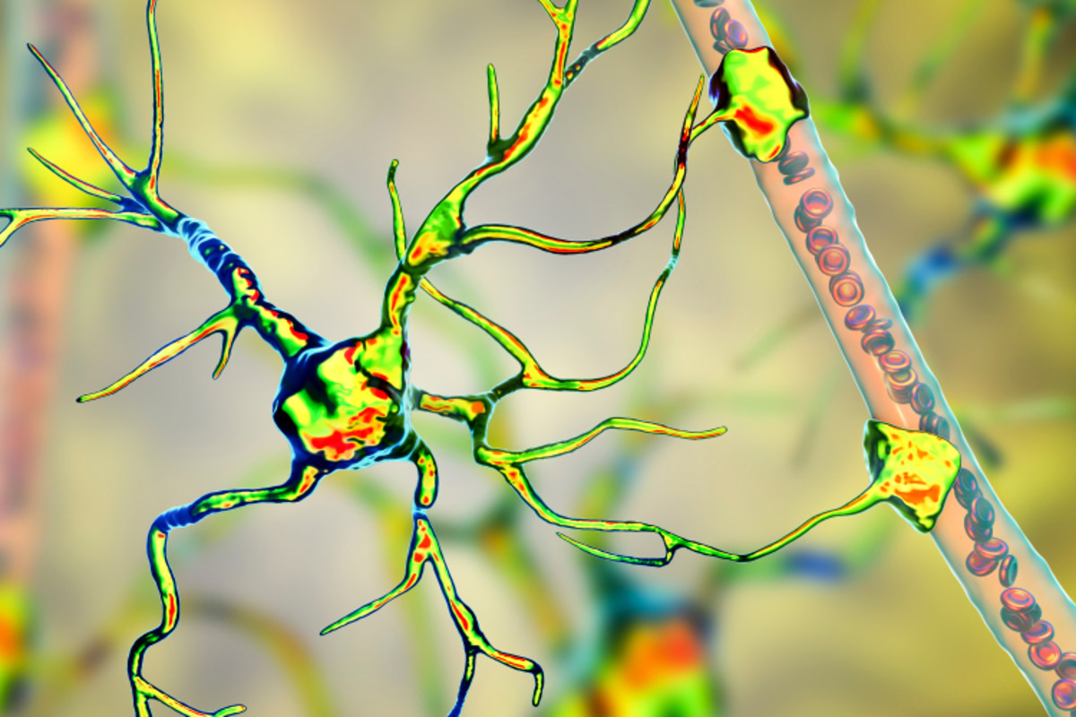 El hombre totalmente paralizado con ALS habla con la familia con la primera tecnología de su tipo