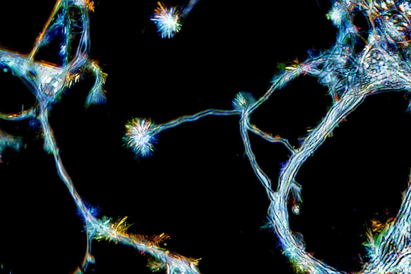 ¿Cultivamos nuevas células cerebrales como adultos? La respuesta parece ser sí