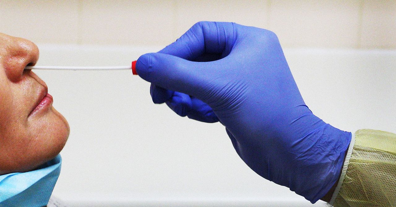 La pandemia parece haber acelerado el envejecimiento cerebral, incluso en personas que nunca fueron covid