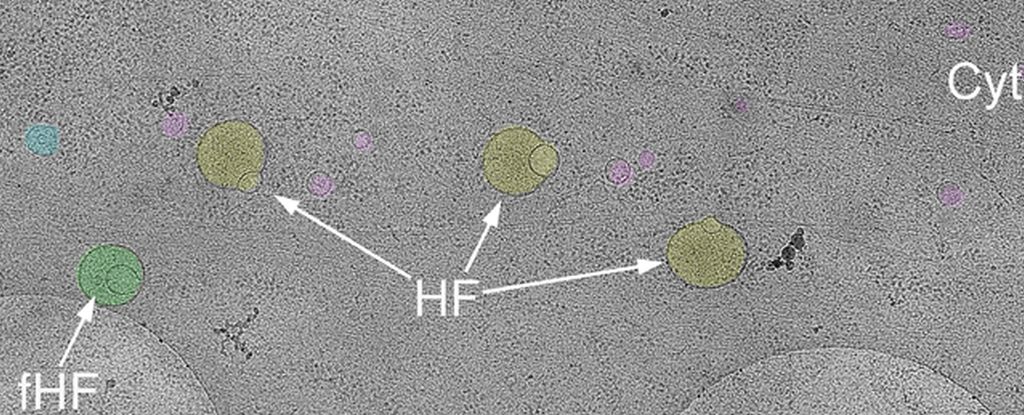 Misteriosa nueva estructura descubierta escondida dentro de las células humanas: Sciencealert