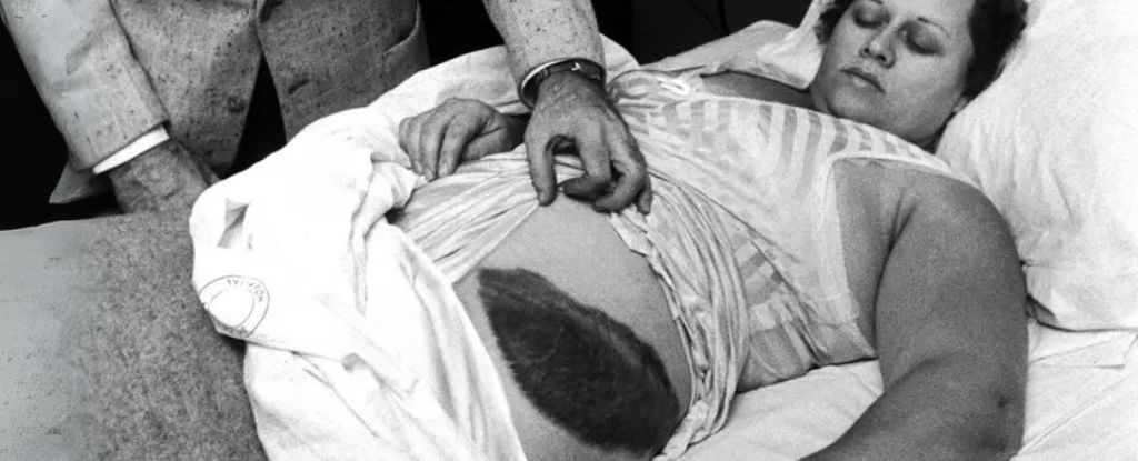Primer huelga de meteorito humano registrado sigue siendo un cuento salvaje 70 años en: Sciencealert