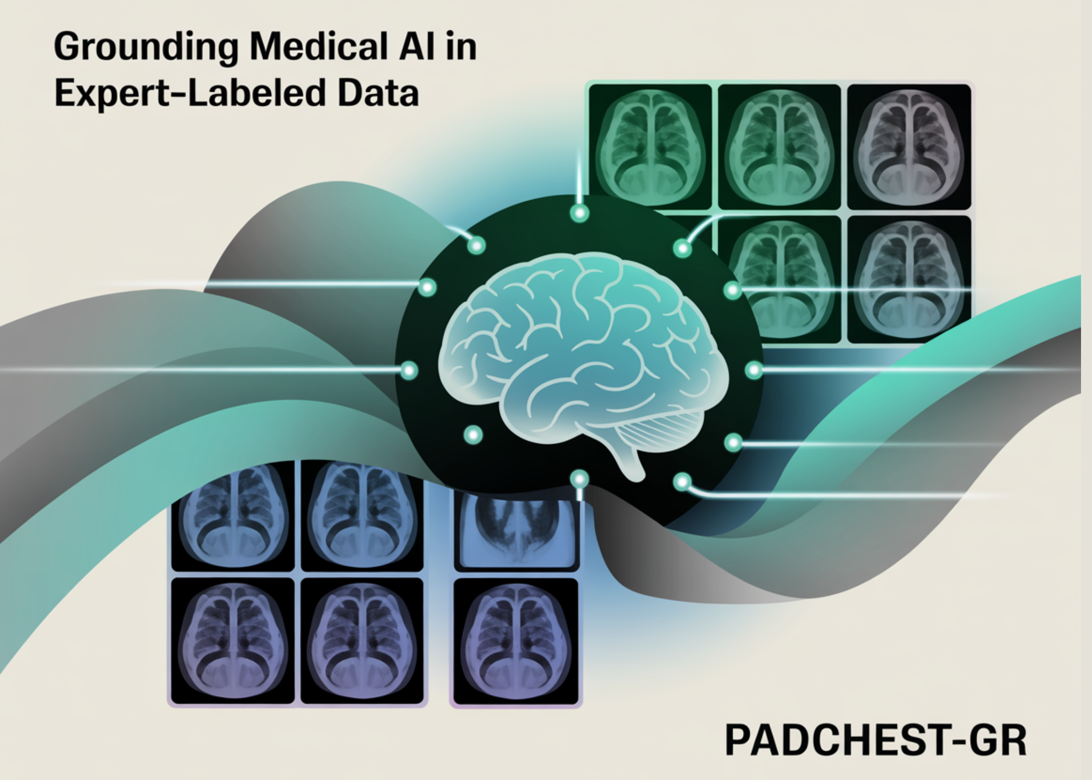 Grounding Medical AI en datos etiquetados con expertos: un estudio de caso sobre Padchest-Gr- El primer conjunto de datos de nivel de oración multimodal, bilingüe para informes de radiología