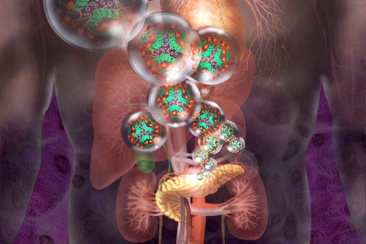 La producción de insulina del paciente de diabetes tipo 1 restaurada con una nueva terapia de trasplante de células
