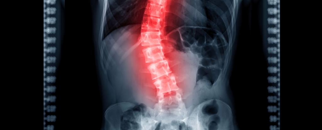 El dolor de espalda impacta el 60% de nosotros: así es como su columna vertebral podría causarlo: Sciencealert