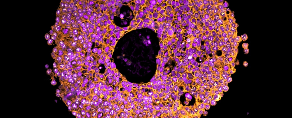 Mini Placentas impresa en 3D en un laboratorio en Amazing World First: Sciencealert